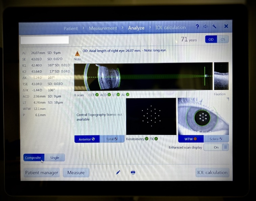 光學生物測量儀圖像