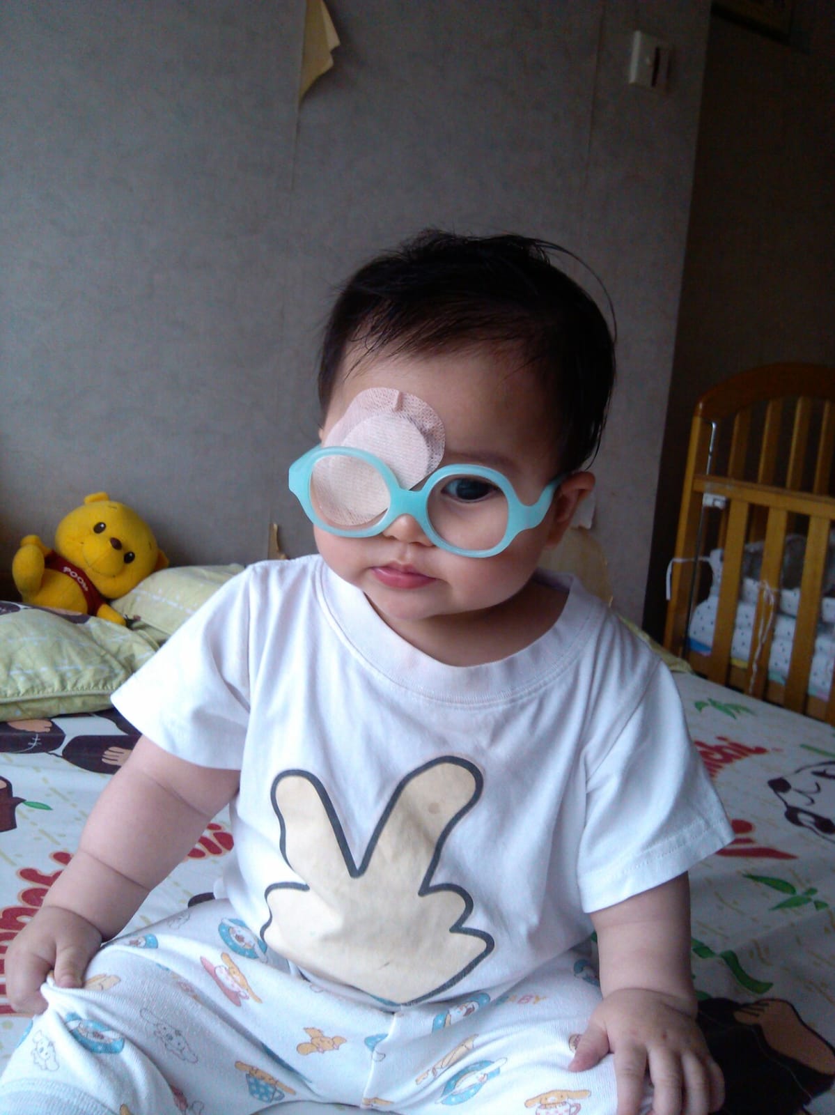 Baby Anna wearing eye patch